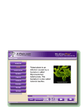 Tuberculosis - Interactive Tutorial