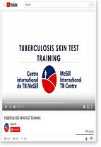 TB Skin Test Training for Heath Care Workers