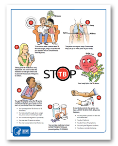 Stop TB Poster