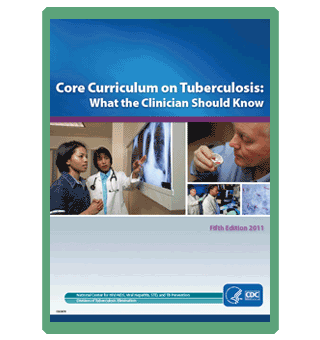 Core Curriculum on Tuberculosis: What the Clinician Should Know