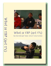 What is TB? (not TV) Video