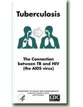 Tuberculosis: The Connection between TB and HIV (the AIDS virus)