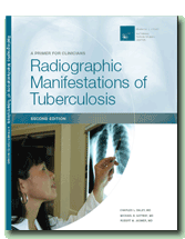 Radiographic Manifestations of Tuberculosis: A Primer for Clinicians, Second Edition