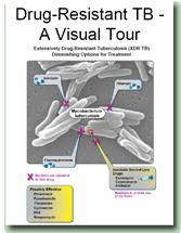 Drug-Resistant TB - A Visual Tour