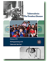 Tuberculosis: The Timeless Disease